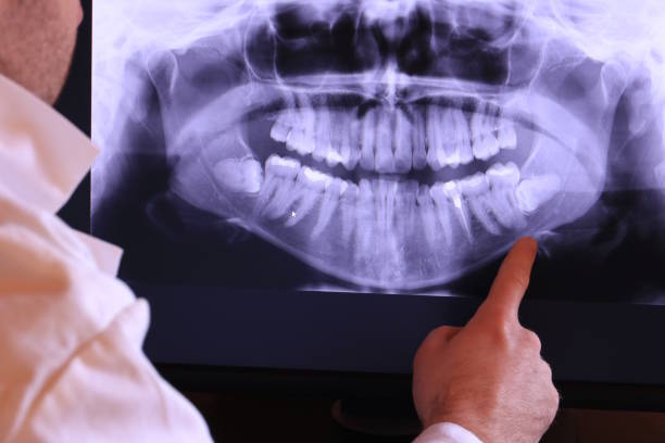 Best Same-Day Emergency Dentist in Wright City, MO