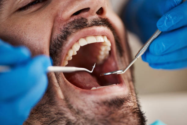 Best Emergency Broken Tooth Repair in Wright City, MO