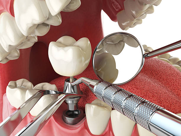 Best Emergency Treatment for Toothache in Wright City, MO